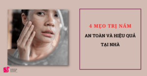 Mẹo trị nám an toàn và hiệu quả