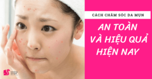 Cách chăm sóc da mụn an toàn và hiệu quả hiện nay