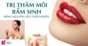 Top 5 mẹo trị thâm môi bẩm sinh bằng nguyên liệu thiên nhiên