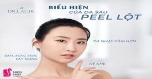 Chăm sóc da như thế nào sau liệu pháp Peel da?