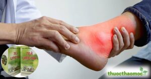 Trà Gout Uricna Trần Kim Huyền có hiệu quả như lời đồn?